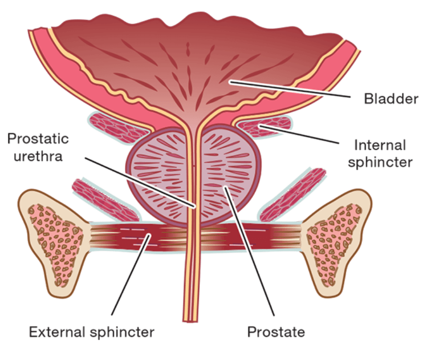 Urinary Incontinence After Prostate Cancer: Causes and Recovery Tips